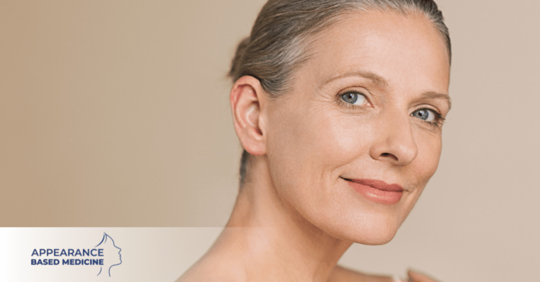 Ageing Skin