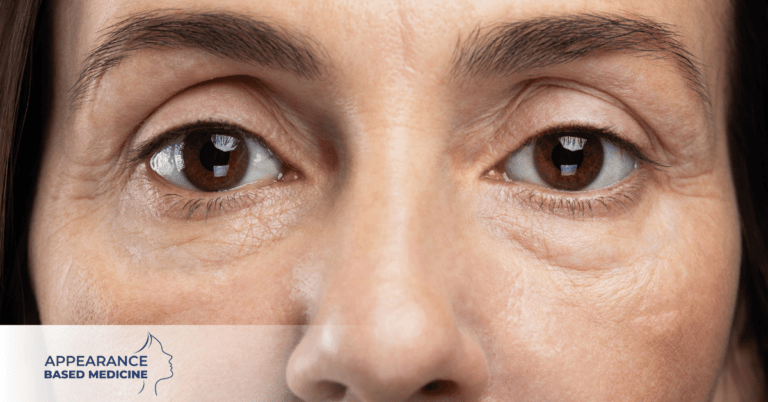 How To Combat Tired Looking Eyes