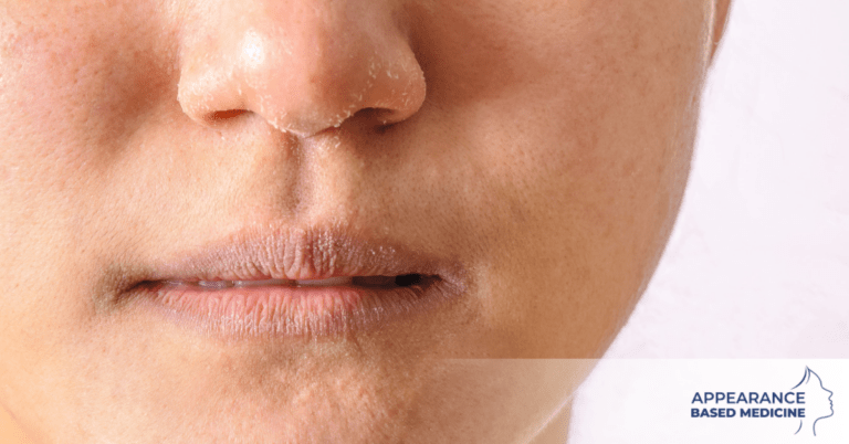 The Best Skincare Tips For Dry Skin