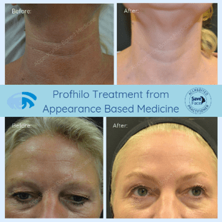 Radiant Skin 3 profhilobanda