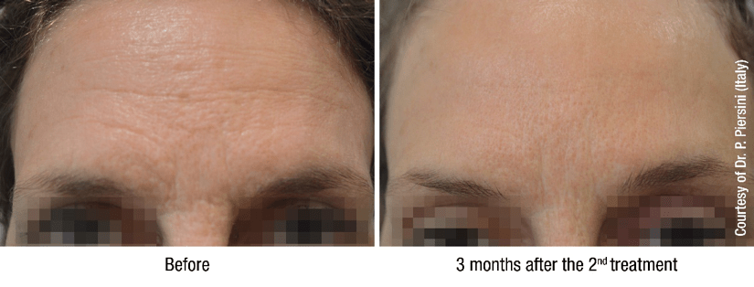 Radiant Skin 4 viscodermbanda