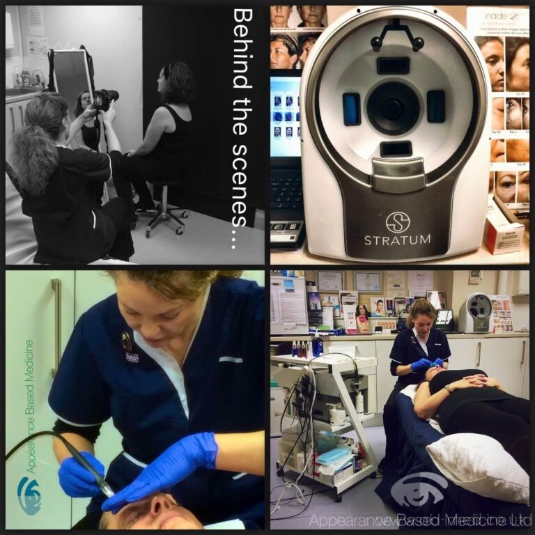 What's it like having a treatment at Appearance Based Medicine