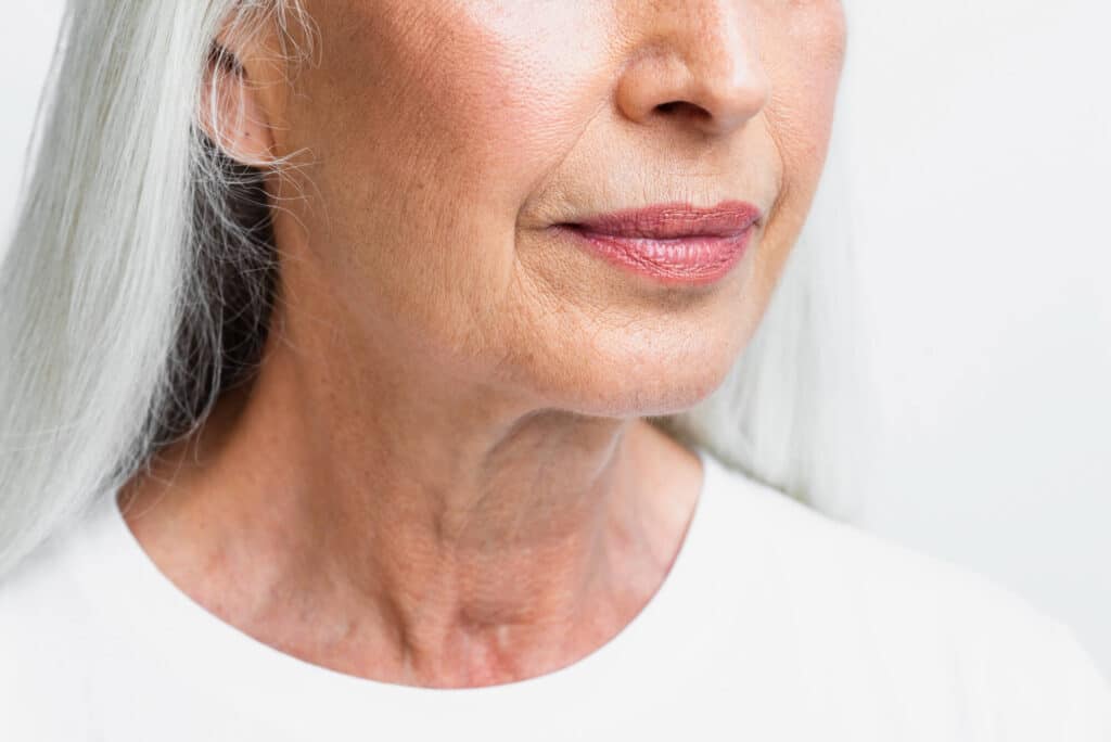 Cheek Fillers: Natural Cheek Enhancement to Restore, Lift and Define 1 why cheeks lose volume