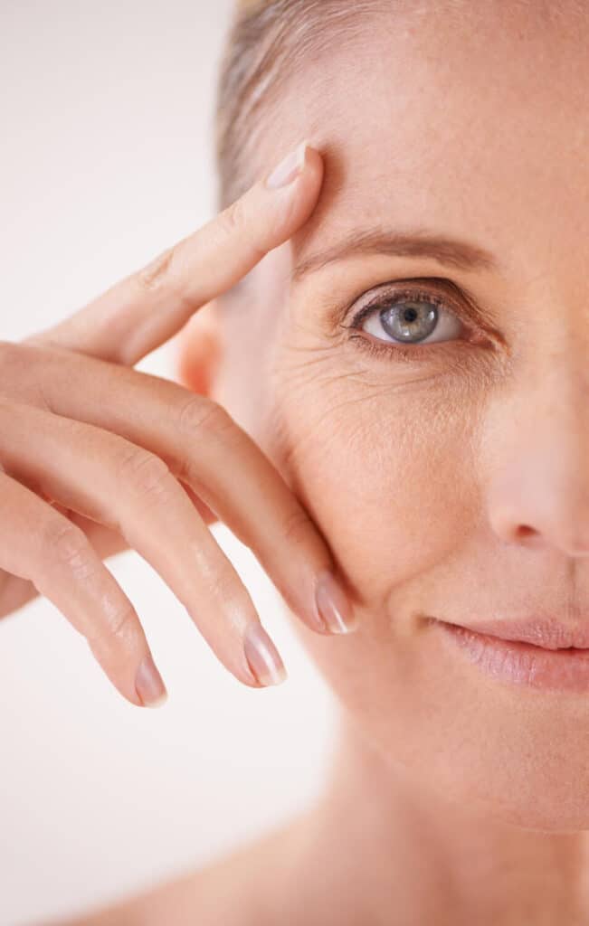 fine lines wrinkles